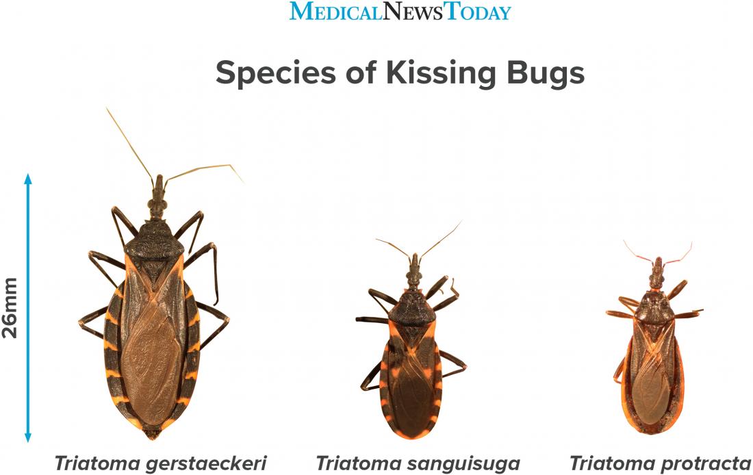 kissing-bug-bites-symptoms-risks-and-treatments-the-medi-info