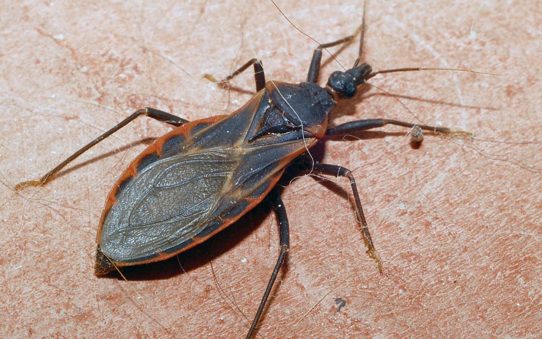 Kissing bug bites: Symptoms, risks, and treatments | The Medi Info
